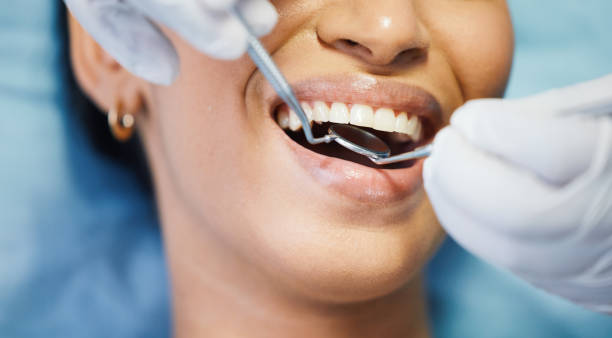 Best Emergency Root Canal Treatment in Wilkesboro, NC