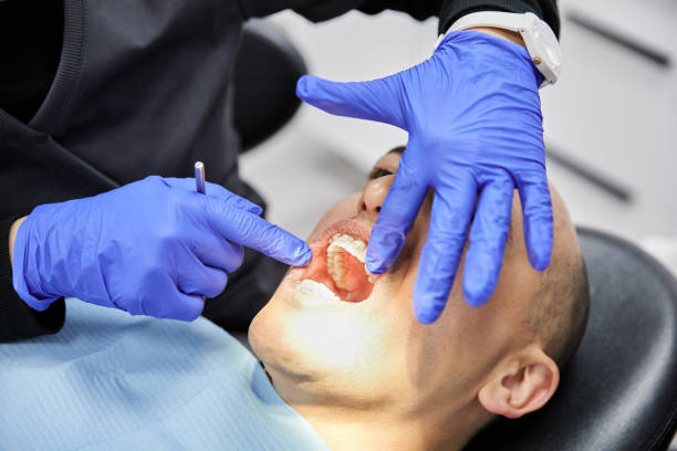 Best Emergency Treatment for Dental Infections or Abscesses in Wilkesboro, NC